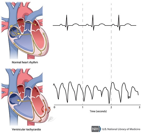 Common Cardiac Conditions - Ballarat Cardiology